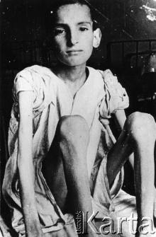 Niedożywione dziecko żydowskie.